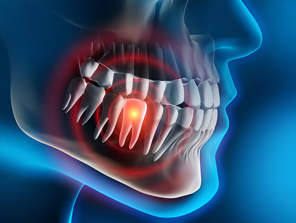 Teeth image - Emergency dentist Blackpool